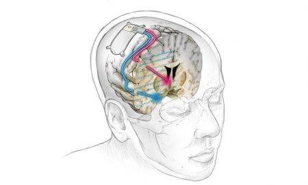 Pirmais smadzeņu implants